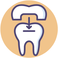 Standard implants and mini implants in Naperville IL incudes crowns, dentures, and more.