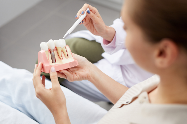 Woman holding a model of teeth showing a dental implant.