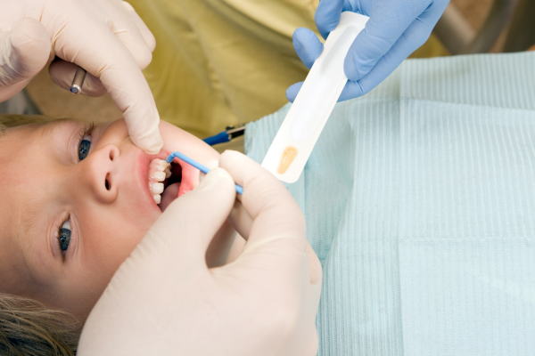 A child receiving a fluoride treatment in Naperville.