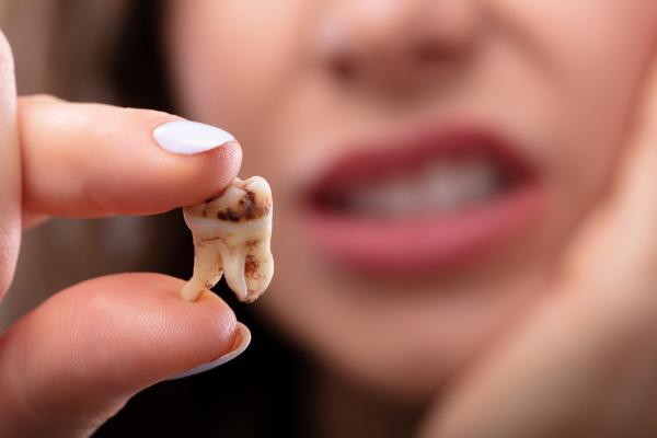 A woman holding up a decayed tooth.