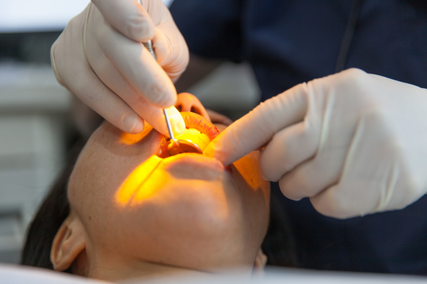 Oral surgery done in office in Naperville.
