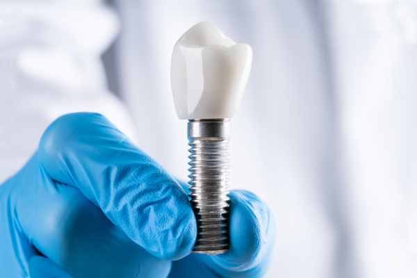 A single tooth implant.