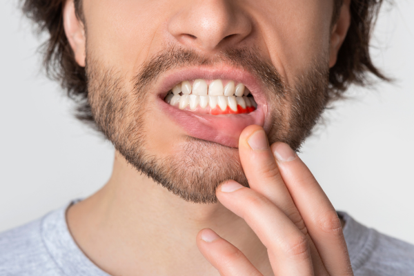 A man with swollen, inflamed gums as a result of a dental infection.